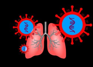 Coronavirus Infection