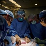 Human Kidney Transplantation