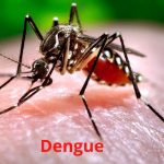 Dengue Fever