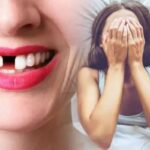 Dreaming about your Teeth Falling Out