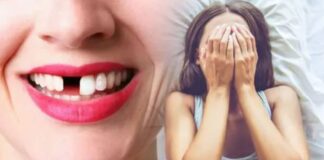 Dreaming about your Teeth Falling Out