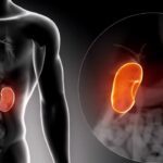 Habits that Harm Your Kidneys