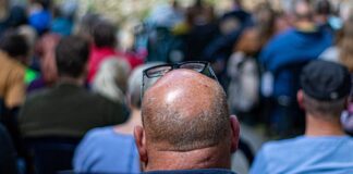 Premature Baldness
